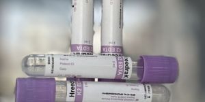 k2 EDTA Safety Cap Blood Collection Tube