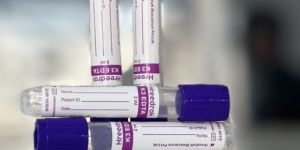 K3 EDTA Safety Cap Blood Collection Tube