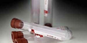 Plain Serum Blood Collection Tube