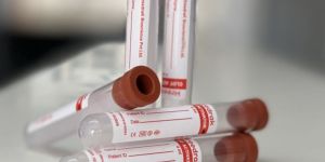 Clot Activator Single Cap Blood Collection Tube