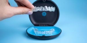 Invisalign Services