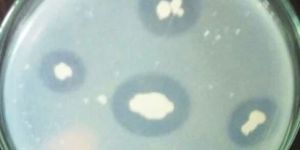 Phosphate Solubilizing Bacteria