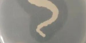 Zinc Solubilizing Bacteria