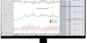 demasvis windows-based software