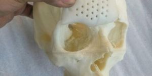 medical 3d prototype printing services