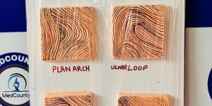 Patterns OF Fingerprint Model