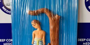 Forensic Suicidal Hanging Model