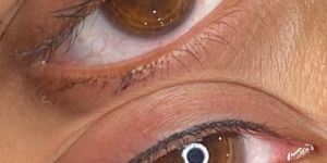 Permanent Eyeliner Treatment