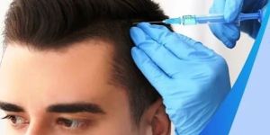 Hair Loss Treatment Service