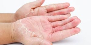 Skin Infection Treatment Service