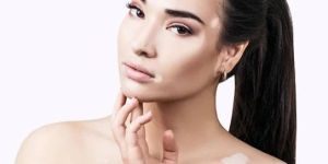 Vitiligo Treatment Service