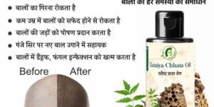 Tataiya Ke Chatte Ka Hair Groth Oil