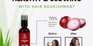 Oriq Herbal Red Onion Blackseed Hair Oil