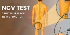 ncv nerve function test service
