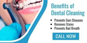 Teeth Whitening Services