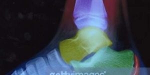 universal X-Ray Film
