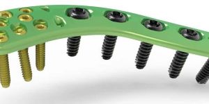 ANTRIOR CLAVICLE LOCKING PLATE