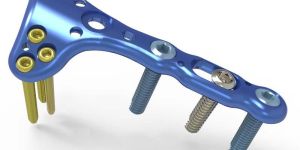 DISTAL RADIUS VOLAR PLATE