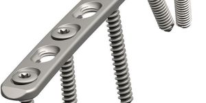 Proximal Tibia Plate