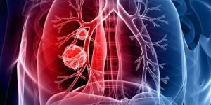 Orthopedic Surgery Services