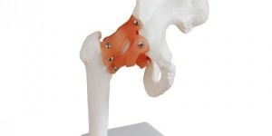 Life-Size Hip Joint