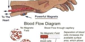 Magnet Therapy