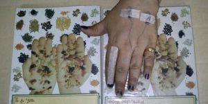 Seed Therapy