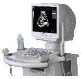 Ultrasound System