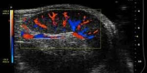 Color Doppler Machine