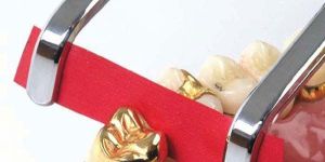 Dental Occlusion Paper