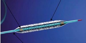 Sirolimus Drug Eluting Stent