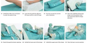 ORTHOPEDIC DRAPES