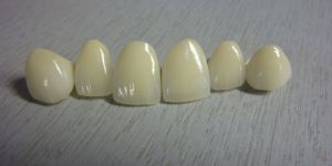 Dental Ceramic Crowns