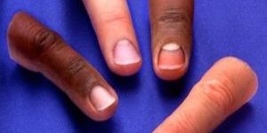 Artificial Silicon Finger