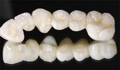 Ips Emax/ips Empress