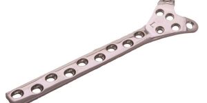 Condylar Buttress Plate