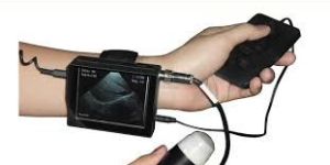 Wrist Ultrasound Scanner