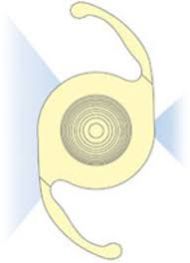 Multifocal Intraocular Lens