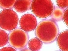 Astaxanthin Supplements