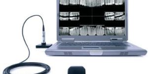 dental  Digital X- rays