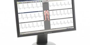 Huntleigh Dopplex DR4 Reporter Software