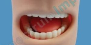 Oral Cavity Model