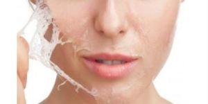 Chemical Peeling Services