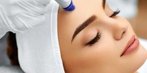 Microdermabrasion Treatment