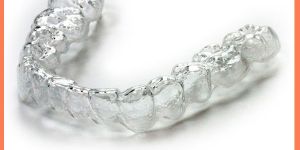 Clear Aligner