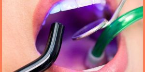 Laser Cosmetic Filling