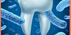 Dental Caries Counselling (Oral Hygiene)