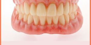Dentures Upper/Lower (Removal)
