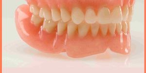 Full Dentures (Removale)