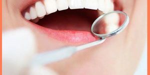 Gum Depigmention Both U/L